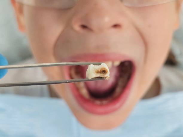 Best Mobile Emergency Dentist in Gosport, IN