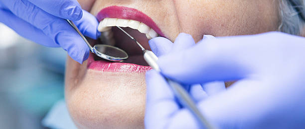 Best Emergency Dental Services for Seniors in Gosport, IN